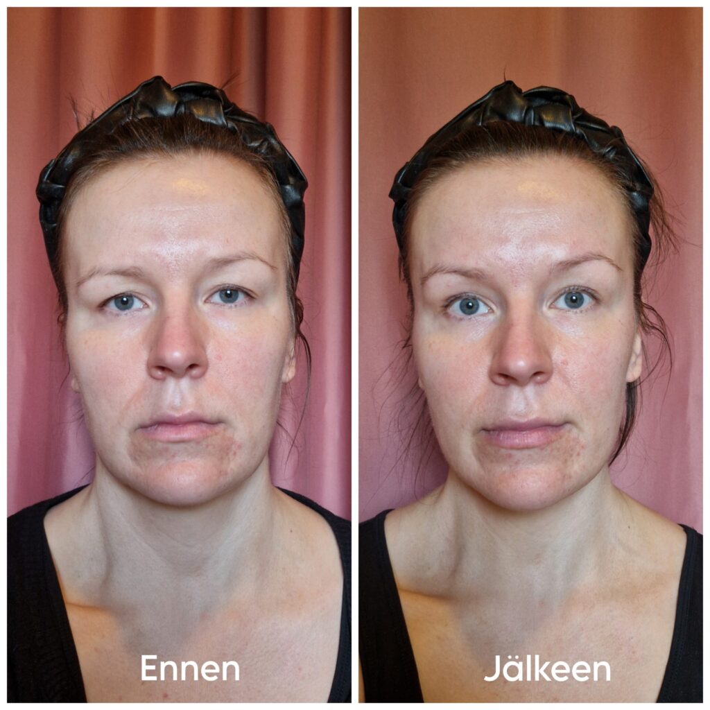 ennen ja jälkeen kasvotreeni_facefeelings